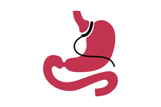 AGB image showing surgery design